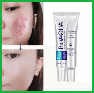 PURE SKIN Acne Scar Removal Rejuvenation Cream